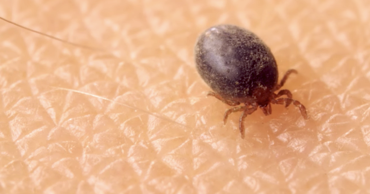 Here's How Ticks Embed in Your Skin, Suck Your… | Grand View Outdoors